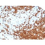 Immunohistochemistry - Anti-AMH Antibody [AMH/6713R] (A277990) - Antibodies.com