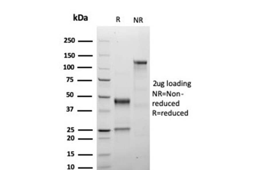 SDS-PAGE - Anti-Growth Hormone Antibody [GH/4886R] (A277991) - Antibodies.com