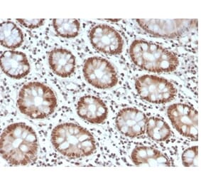 Immunohistochemistry - Anti-MSH6 Antibody [MSH6/4592R] (A277992) - Antibodies.com