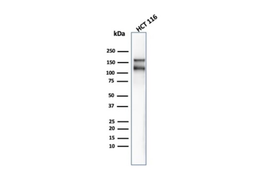 Western Blot - Anti-MSH6 Antibody [MSH6/4592R] (A277992) - Antibodies.com