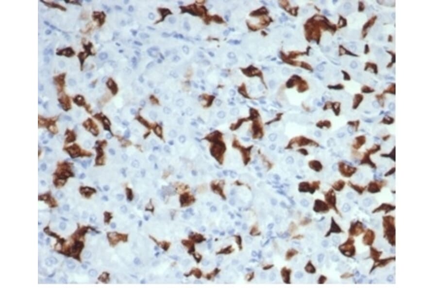 Immunohistochemistry - Anti-MSH6 Antibody [MSH6/7065R] (A277993) - Antibodies.com