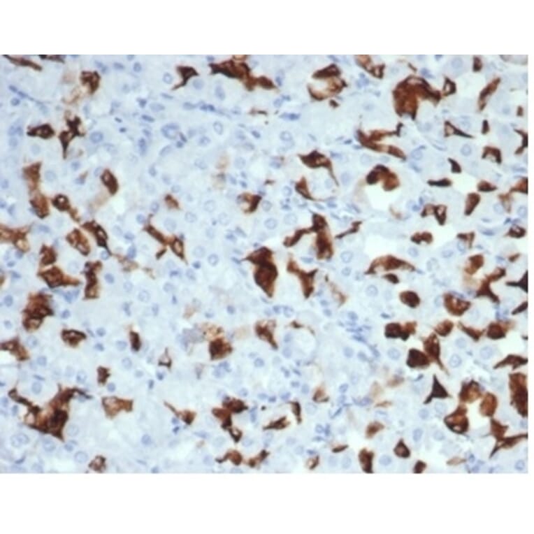 Immunohistochemistry - Anti-MSH6 Antibody [MSH6/7065R] (A277993) - Antibodies.com