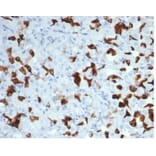 Immunohistochemistry - Anti-MSH6 Antibody [MSH6/7065R] (A277993) - Antibodies.com