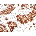 Immunohistochemistry - Anti-MSH6 Antibody [MSH6/7065R] (A277993) - Antibodies.com