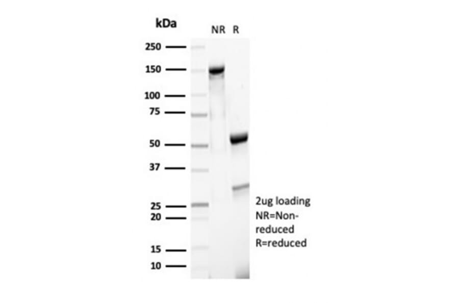 SDS-PAGE - Anti-MSH6 Antibody [MSH6/7065R] (A277993) - Antibodies.com