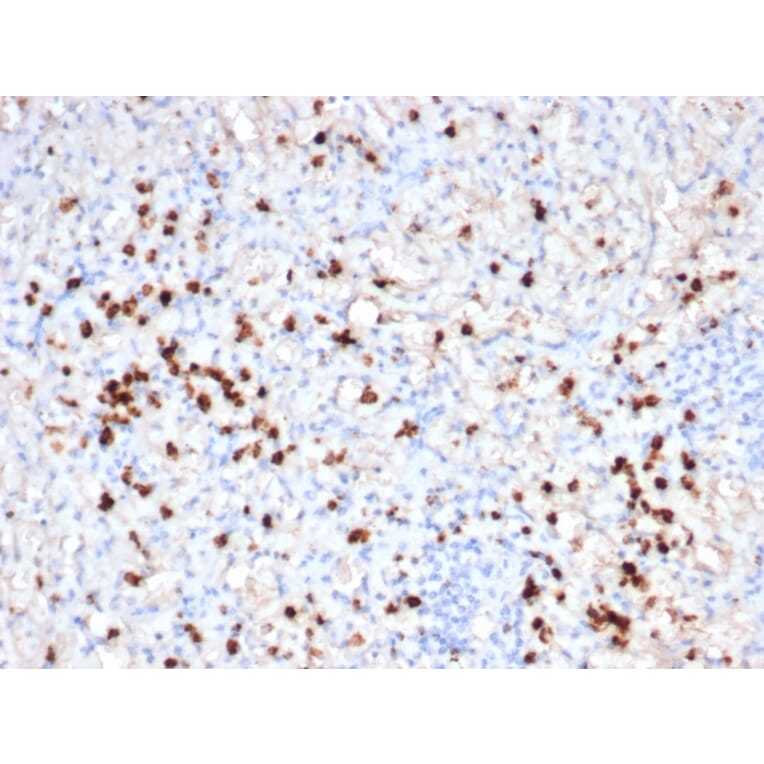 Immunohistochemistry - Anti-Granzyme B Antibody [GZMB/6530R] (A277994) - Antibodies.com