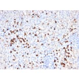 Immunohistochemistry - Anti-Granzyme B Antibody [GZMB/6530R] (A277994) - Antibodies.com