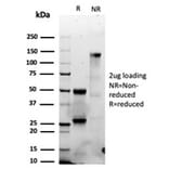 SDS-PAGE - Anti-Granzyme B Antibody [GZMB/6530R] (A277994) - Antibodies.com