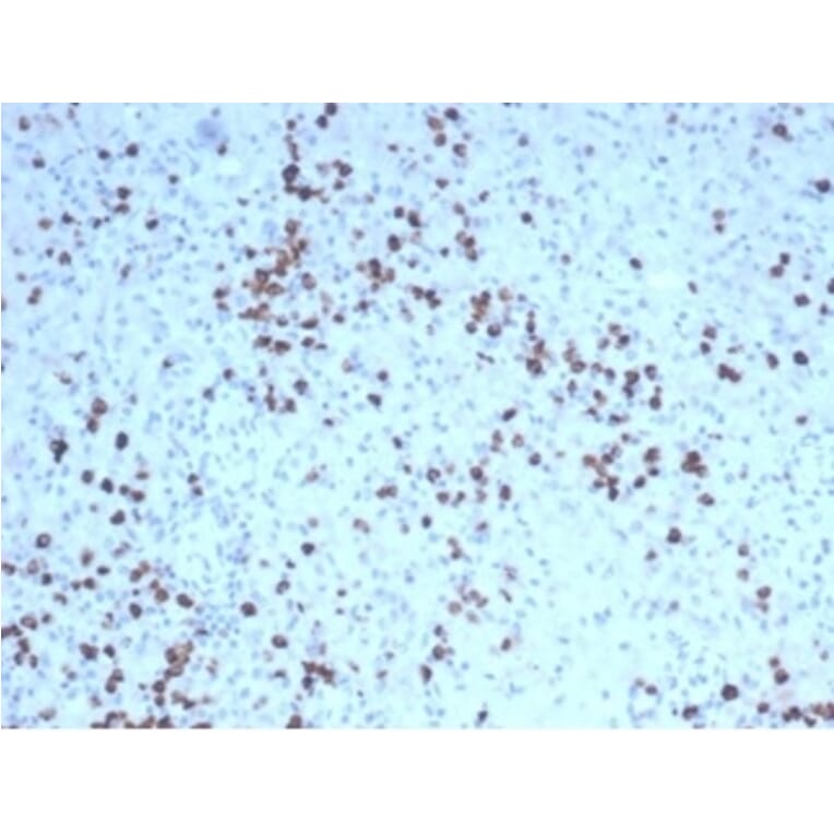 Immunohistochemistry - Anti-Granzyme B Antibody [GZMB/4539R] (A277995) - Antibodies.com