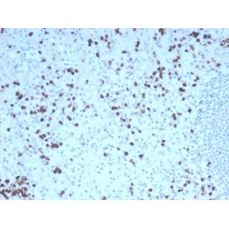 Immunohistochemistry - Anti-Granzyme B Antibody [GZMB/4539R] (A277995) - Antibodies.com