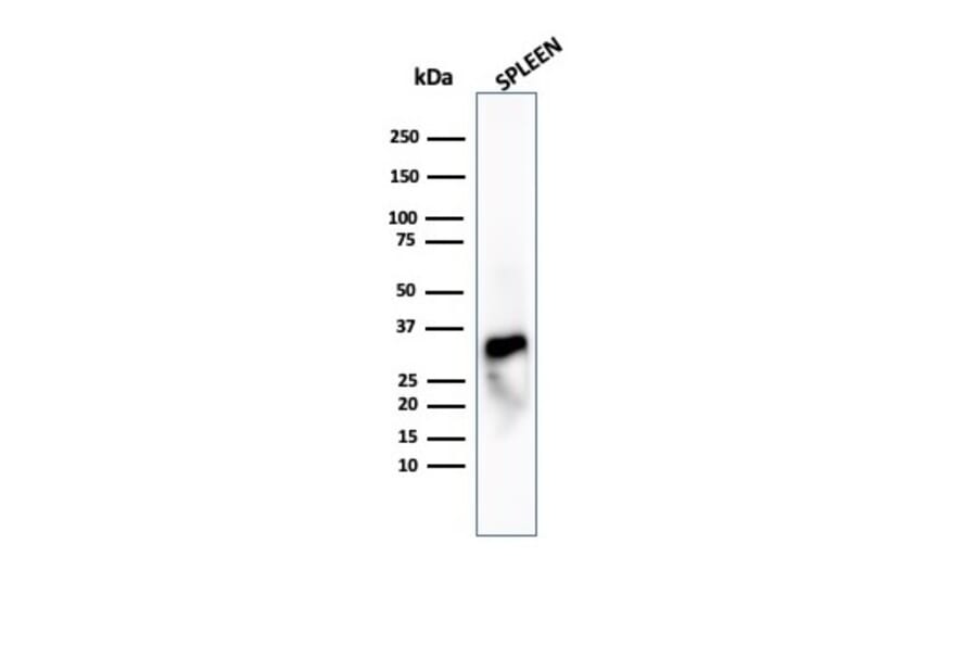 Western Blot - Anti-Granzyme B Antibody [GZMB/4539R] (A277995) - Antibodies.com