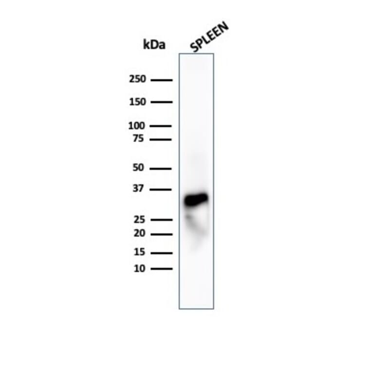 Western Blot - Anti-Granzyme B Antibody [GZMB/4539R] (A277995) - Antibodies.com
