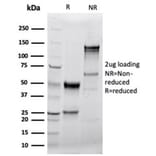 SDS-PAGE - Anti-Granzyme B Antibody [GZMB/4539R] (A277995) - Antibodies.com