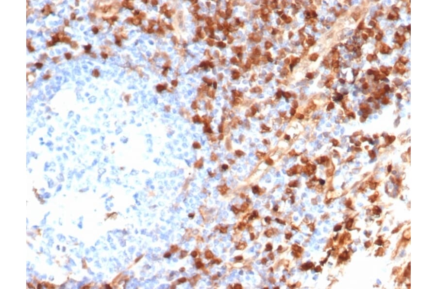 Immunohistochemistry - Anti-Annexin A1 Antibody [ANXA1/6452R] (A277996) - Antibodies.com