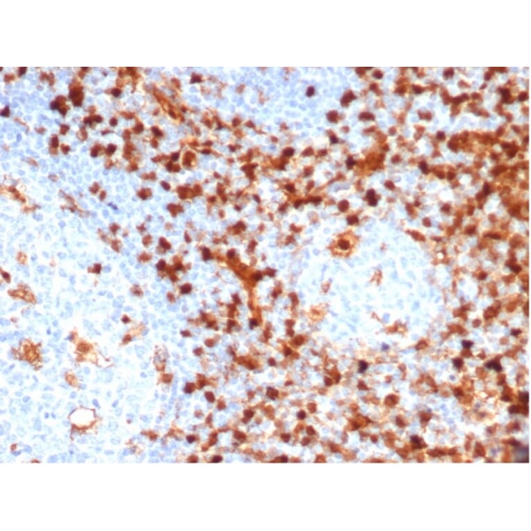 Immunohistochemistry - Anti-Annexin A1 Antibody [ANXA1/6452R] (A277996) - Antibodies.com