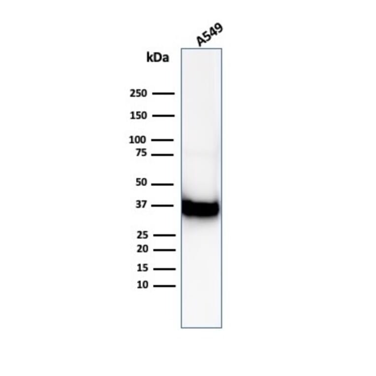 Western Blot - Anti-Annexin A1 Antibody [ANXA1/6452R] (A277996) - Antibodies.com