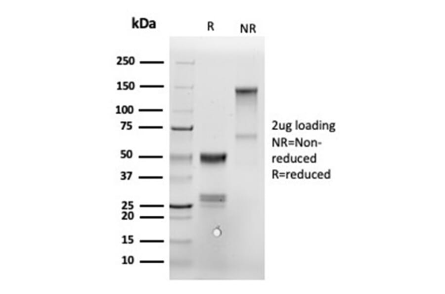 SDS-PAGE - Anti-Annexin A1 Antibody [ANXA1/6452R] (A277996) - Antibodies.com