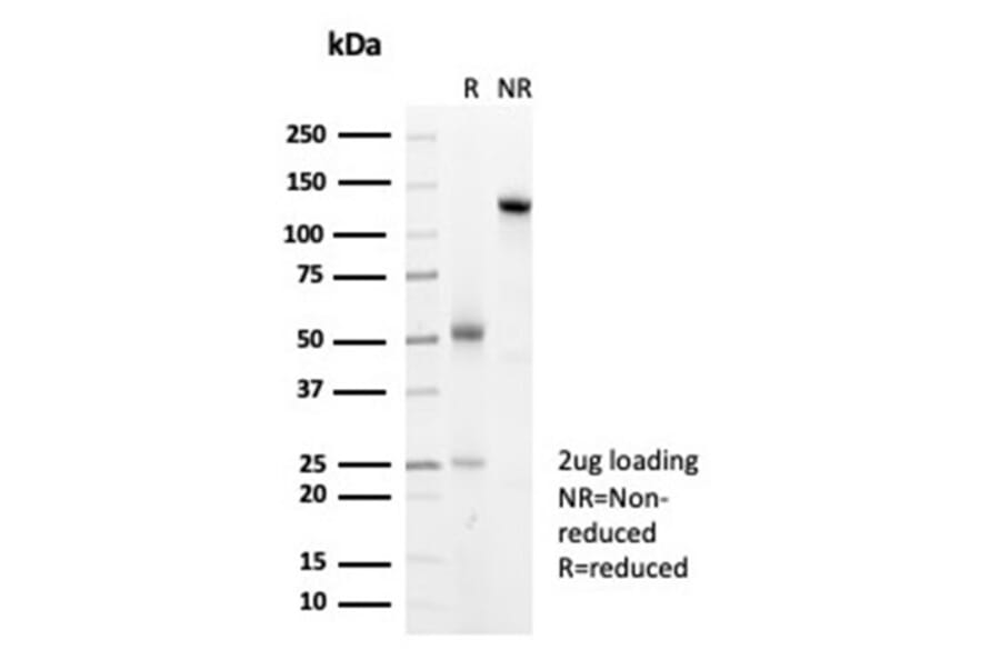 SDS-PAGE - Anti-HSP27 Antibody [HSPB1/7038R] (A277997) - Antibodies.com