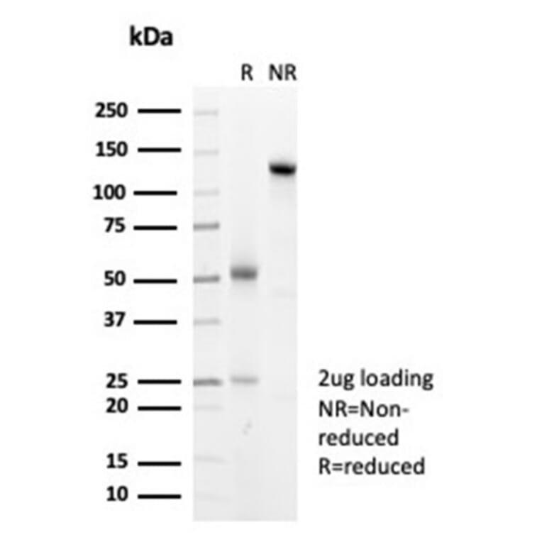 SDS-PAGE - Anti-HSP27 Antibody [HSPB1/7038R] (A277997) - Antibodies.com
