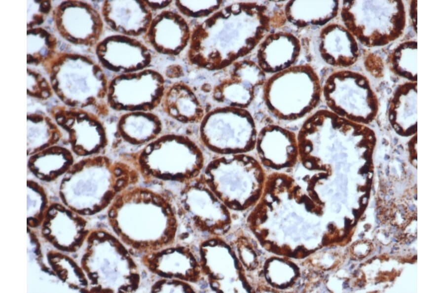 Immunohistochemistry - Anti-HSP60 Antibody [HSPD1/6498R] (A277998) - Antibodies.com