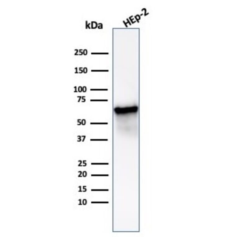 Western Blot - Anti-HSP60 Antibody [HSPD1/6498R] (A277998) - Antibodies.com