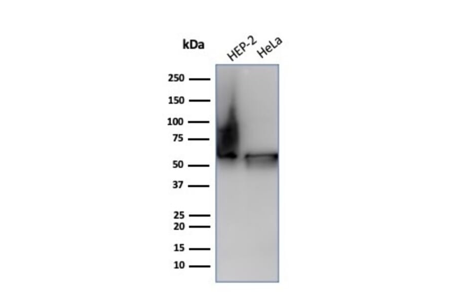 Western Blot - Anti-HSP60 Antibody [HSPD1/6498R] (A277998) - Antibodies.com