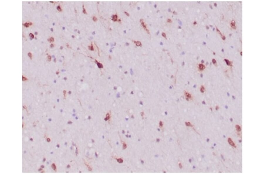 Immunohistochemistry - Anti-IDH1 (mutated R132H) Antibody [IDH1/6806R] (A277999) - Antibodies.com