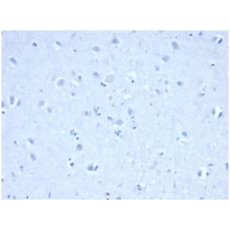 Immunohistochemistry - Anti-IDH1 (mutated R132H) Antibody [IDH1/6806R] (A277999) - Antibodies.com