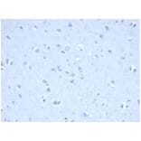 Immunohistochemistry - Anti-IDH1 (mutated R132H) Antibody [IDH1/6806R] (A277999) - Antibodies.com