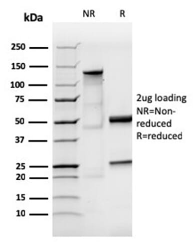 SDS-PAGE analysis of Anti-Human IgA Heavy Chain Antibody [IGHA/3877R] under non-reduced and reduced conditions; showing intact IgG and intact heavy and light chains, respectively. SDS-PAGE analysis confirms the integrity and purity of the antibody.