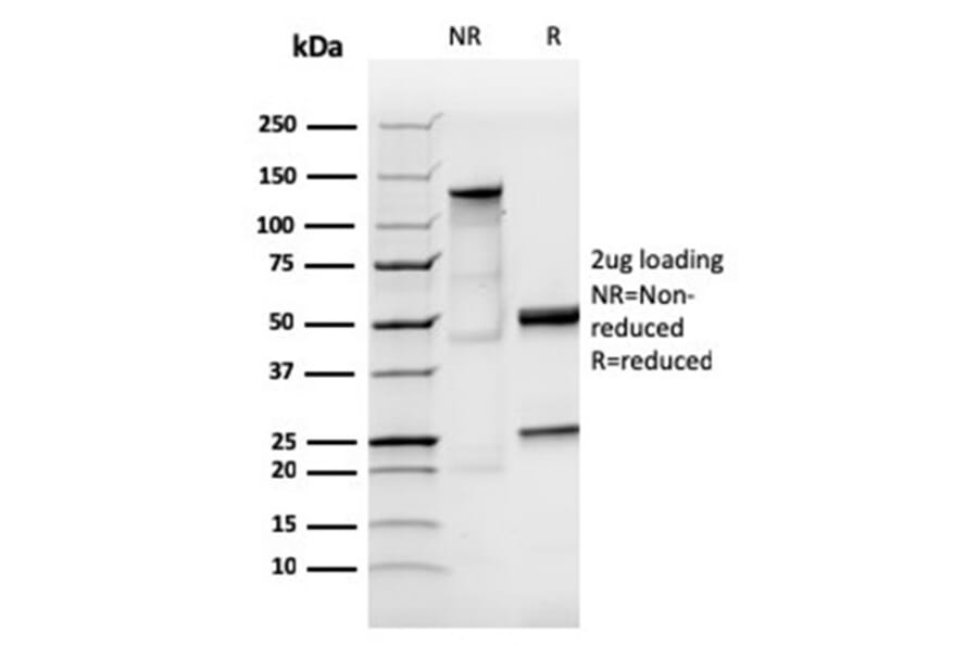 SDS-PAGE - Anti-Human IgA Heavy Chain Antibody [IGHA/3877R] (A278000) - Antibodies.com