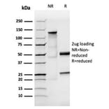 SDS-PAGE - Anti-Human IgA Heavy Chain Antibody [IGHA/3877R] (A278000) - Antibodies.com