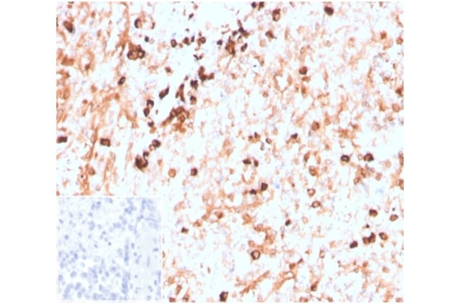 Immunohistochemistry - Anti-Lambda Light Chain Antibody [LLC/3774R] (A278001) - Antibodies.com