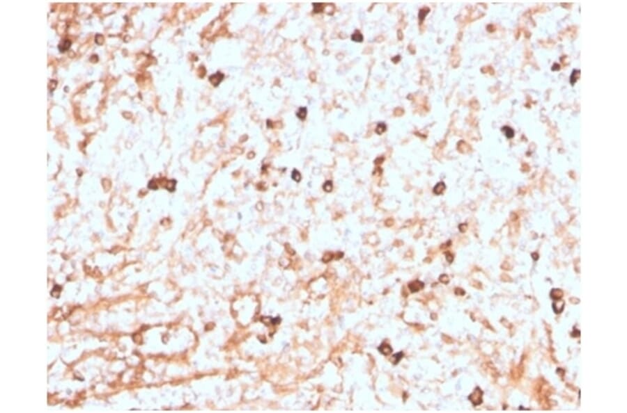 Immunohistochemistry - Anti-Lambda Light Chain Antibody [LLC/3774R] (A278001) - Antibodies.com