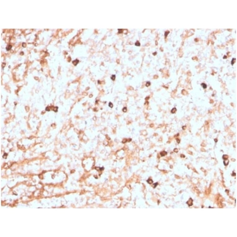 Immunohistochemistry - Anti-Lambda Light Chain Antibody [LLC/3774R] (A278001) - Antibodies.com