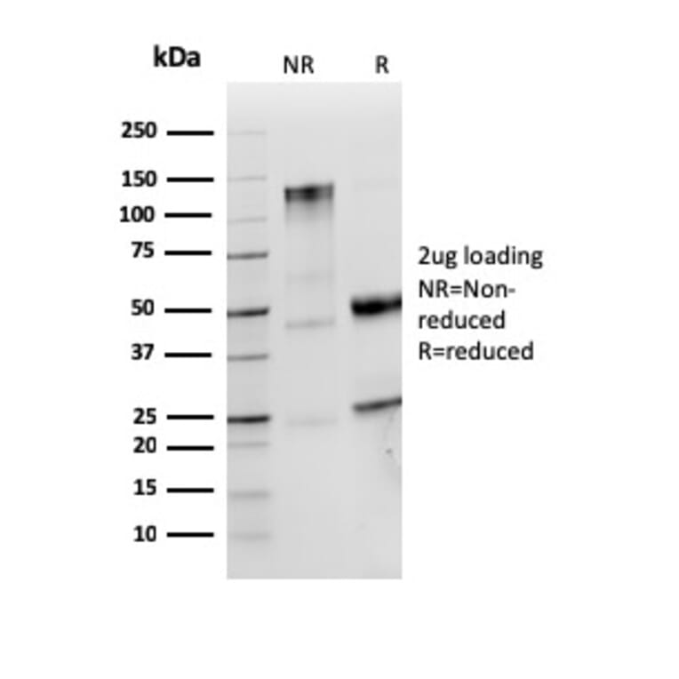 SDS-PAGE - Anti-Lambda Light Chain Antibody [LLC/3774R] (A278001) - Antibodies.com