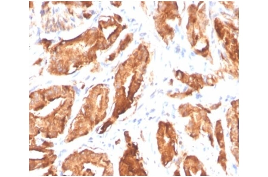 Immunohistochemistry - Anti-Prostate Specific Antigen Antibody [KLK3/4602R] (A278002) - Antibodies.com