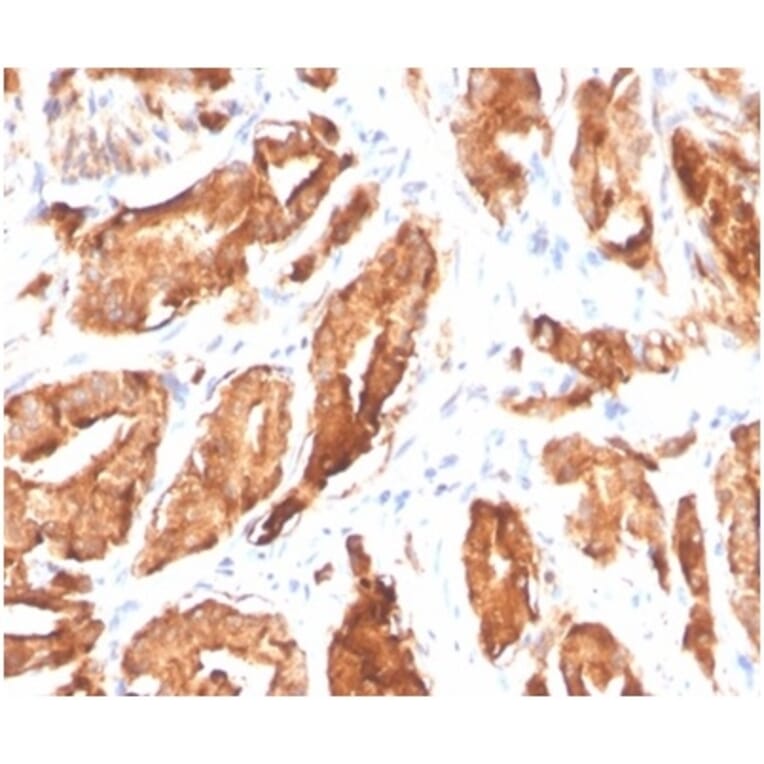 Immunohistochemistry - Anti-Prostate Specific Antigen Antibody [KLK3/4602R] (A278002) - Antibodies.com