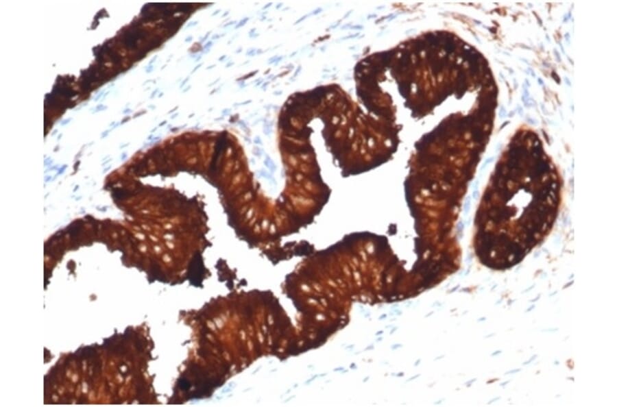 Immunohistochemistry - Anti-Prostate Specific Antigen Antibody [KLK3/4602R] (A278002) - Antibodies.com