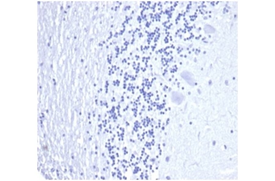 Immunohistochemistry - Anti-Prostate Specific Antigen Antibody [KLK3/4602R] (A278002) - Antibodies.com