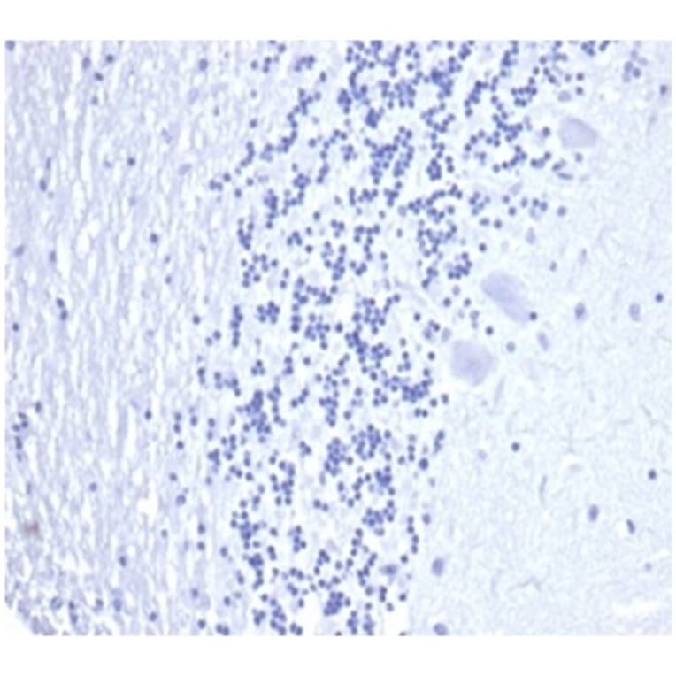 Immunohistochemistry - Anti-Prostate Specific Antigen Antibody [KLK3/4602R] (A278002) - Antibodies.com