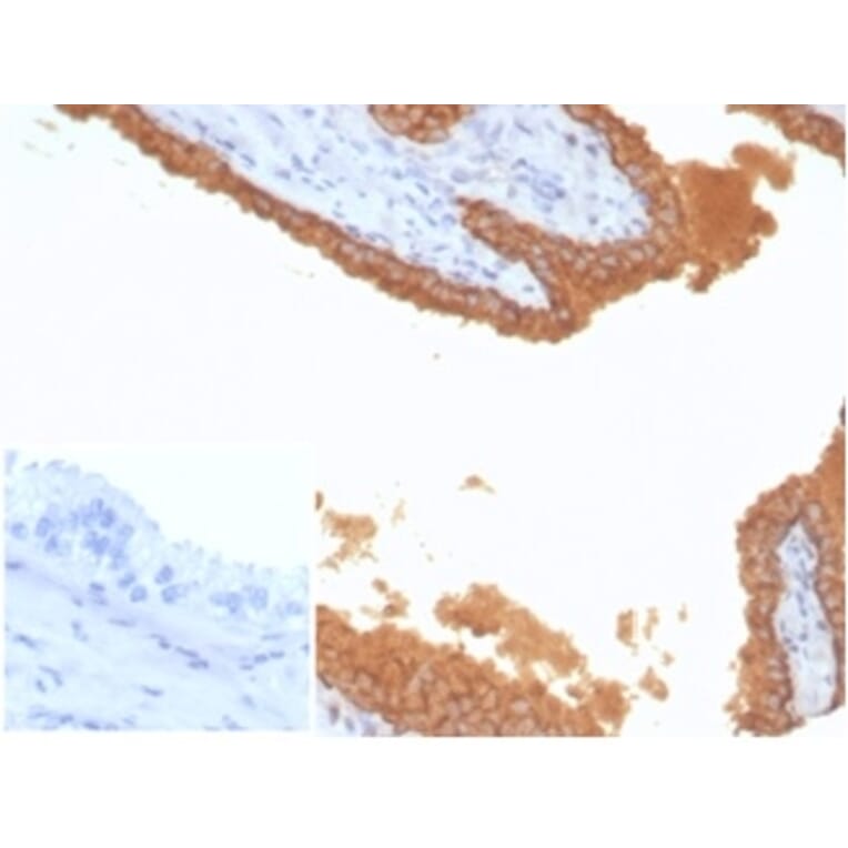 Immunohistochemistry - Anti-Prostate Specific Antigen Antibody [KLK3/7128R] (A278003) - Antibodies.com