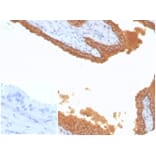 Immunohistochemistry - Anti-Prostate Specific Antigen Antibody [KLK3/7128R] (A278003) - Antibodies.com
