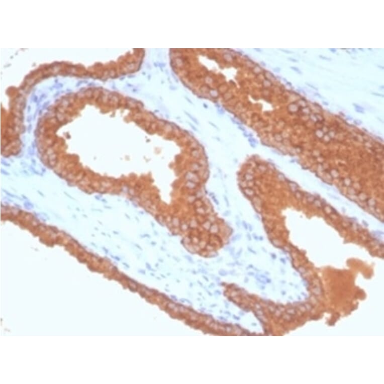 Immunohistochemistry - Anti-Prostate Specific Antigen Antibody [KLK3/7128R] (A278003) - Antibodies.com