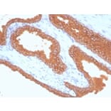 Immunohistochemistry - Anti-Prostate Specific Antigen Antibody [KLK3/7128R] (A278003) - Antibodies.com