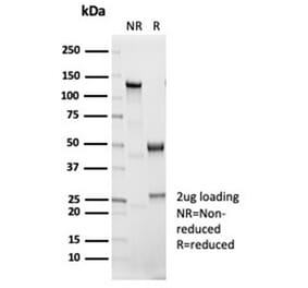 SDS-PAGE - Anti-IL-1 beta Antibody [IL1B/7049R] (A278004) - Antibodies.com