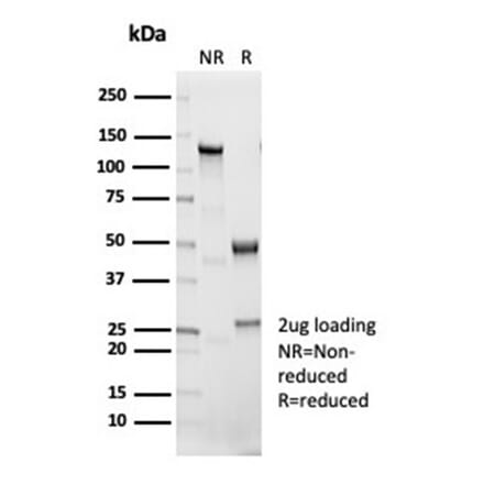 SDS-PAGE - Anti-IL-1 beta Antibody [IL1B/7049R] (A278004) - Antibodies.com