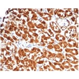 Immunohistochemistry - Anti-IL-2 Antibody [IL2/7051R] (A278005) - Antibodies.com