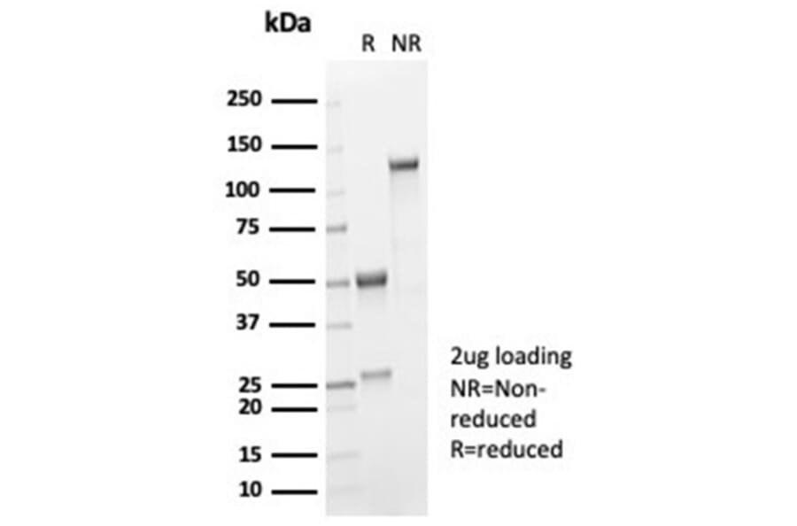 SDS-PAGE - Anti-IL-2 Antibody [IL2/7051R] (A278005) - Antibodies.com