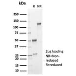 SDS-PAGE - Anti-IL-2 Antibody [IL2/7051R] (A278005) - Antibodies.com